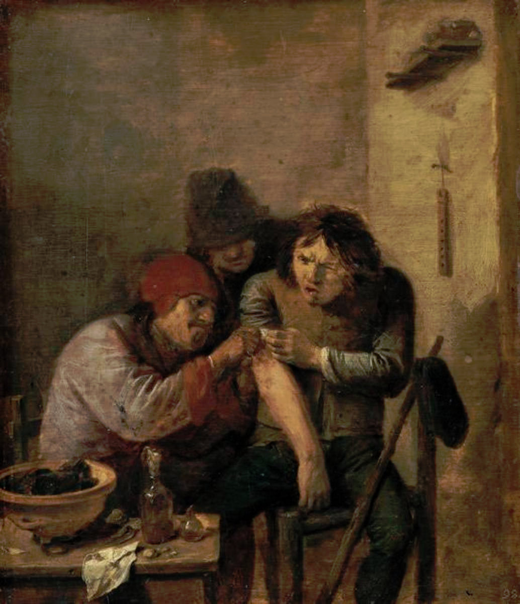 Chirurgien du village (Allégorie du sens du toucher) - Adriaen Brouwer