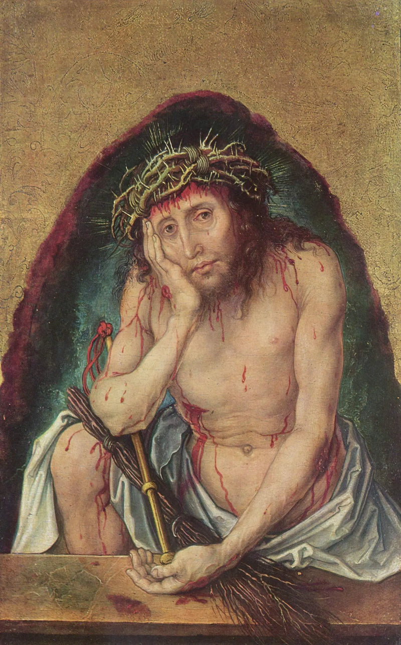 Muž bolesti - Albrecht Dürer